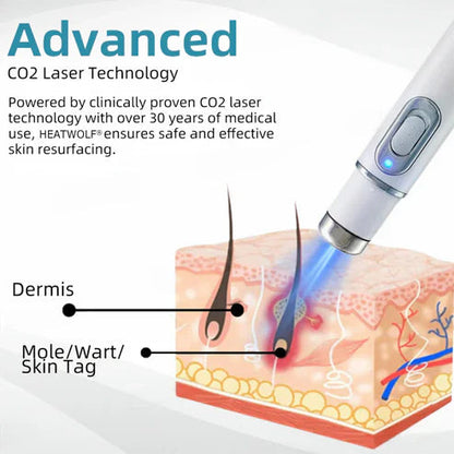 Xorita Non-Invasive Mole and Wart Removal Pen